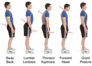 i vari tipi di postura
