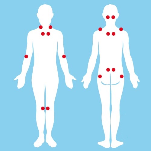 fibromialgia fisiosan