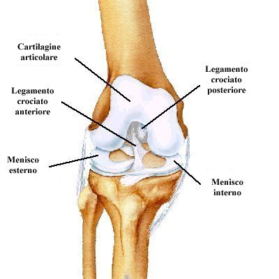 rottura menisco