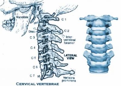 cervical