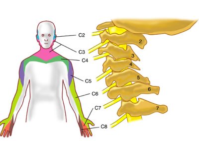 dermatomeri