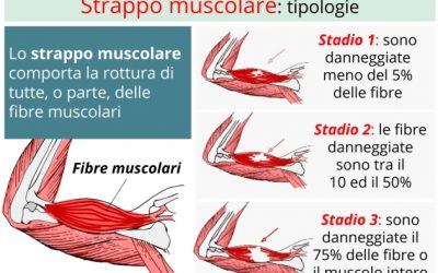 Strappi muscolari e temperatura muscolare: Quale nesso?