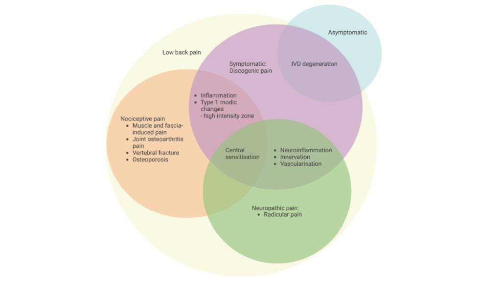 Il dolore alla schiena che nasce dal disco intervertebrale_lombalgia discogenica