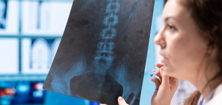 Mal di schiena e tumore vertebrale il caso che insegna a riconoscere i segnali senza panico