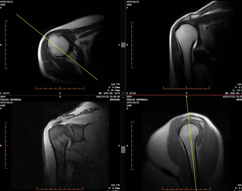 \\StorageNAS\lavori\Fisiosan\2026\POST\IMMAGINI E MATERIALI\la risonanza spiega davvero il dolore